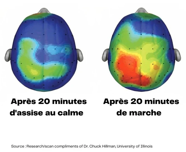 scanner cérébral expliquant pourquoi prendre l’air est essentiel pour être plus productif au travail